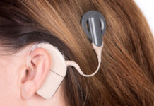 India-Australia trade deal to boost access to Cochlear Ltd cochlear implants in India