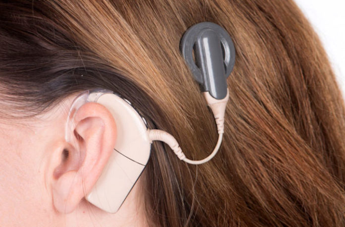 cochlear implants